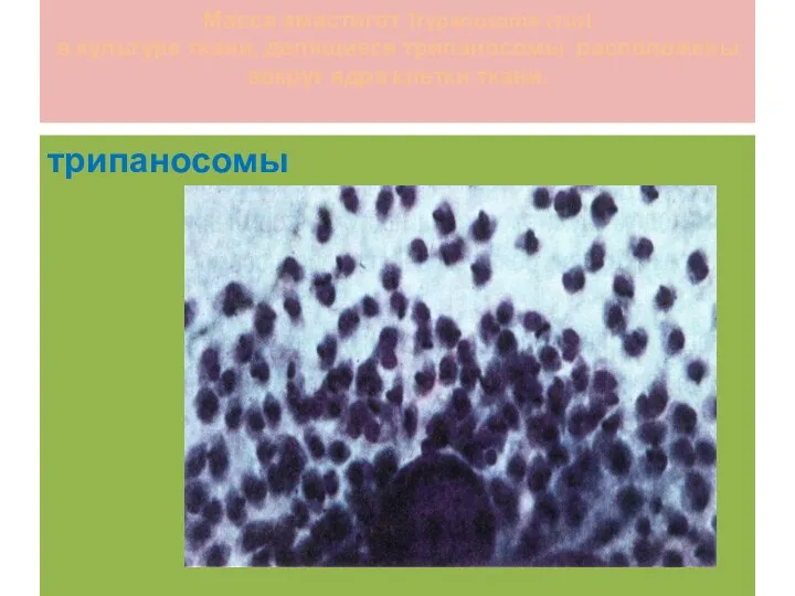 Масса амастигот Trypanosoma cruzi в культуре ткани, делящиеся трипаносомы расположены вокруг ядра клетки ткани. трипаносомы