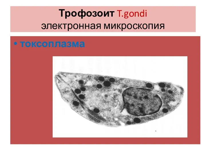 Трофозоит T.gondi электронная микроскопия токсоплазма