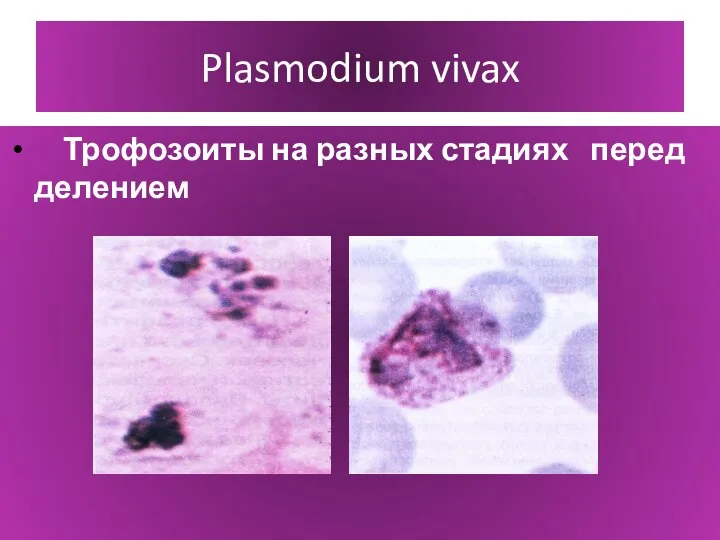Plasmodium vivax Трофозоиты на разных стадиях перед делением