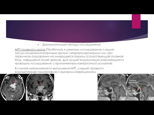 Дополнительные методы исследования: МРТ головного мозга (Прибегнуть к данному исследованию следует после
