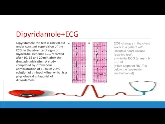 Dipyridamole+ECG Dipyridamole the test is carried out under constant supervision of the