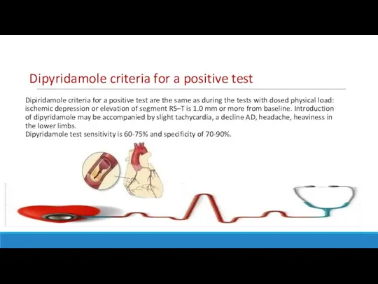 Dipiridamole criteria for a positive test are the same as during the