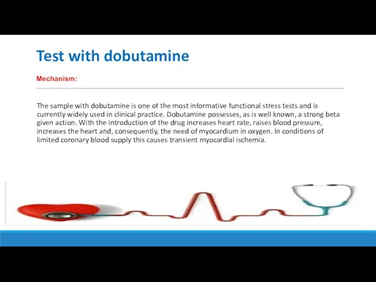 Test with dobutamine The sample with dobutamine is one of the most