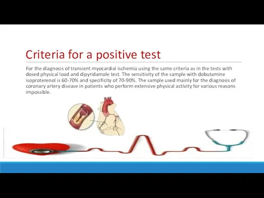 Criteria for a positive test For the diagnosis of transient myocardial ischemia