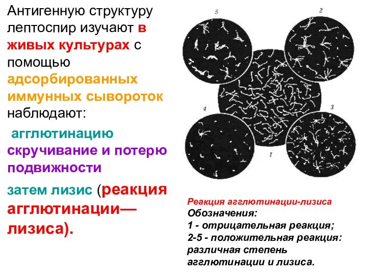 Антигенную структуру лептоспир изучают в живых культурах с помощью адсорбированных иммунных сывороток