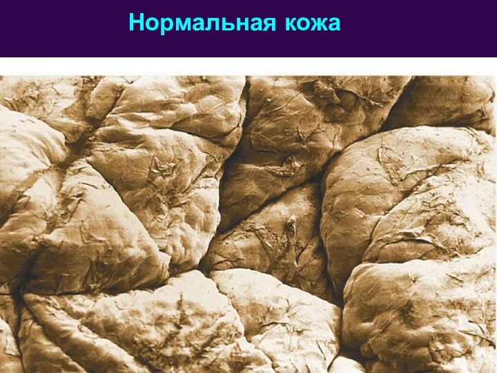 Нормальная кожа