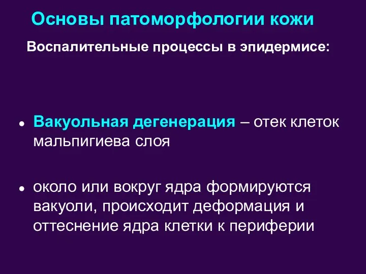 Основы патоморфологии кожи Вакуольная дегенерация – отек клеток мальпигиева слоя около или