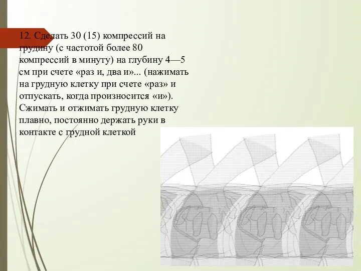 12. Сделать 30 (15) компрессий на грудину (с частотой более 80 компрессий