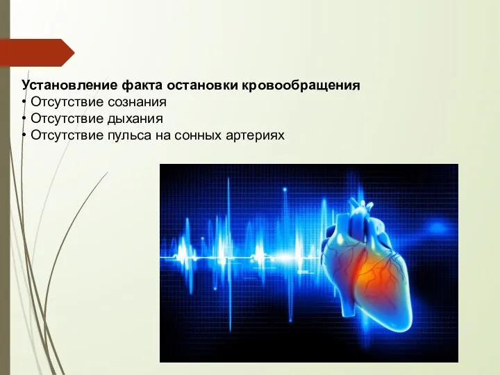 Установление факта остановки кровообращения • Отсутствие сознания • Отсутствие дыхания • Отсутствие пульса на сонных артериях