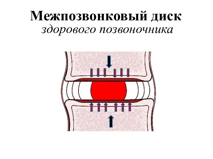 Межпозвонковый диск здорового позвоночника