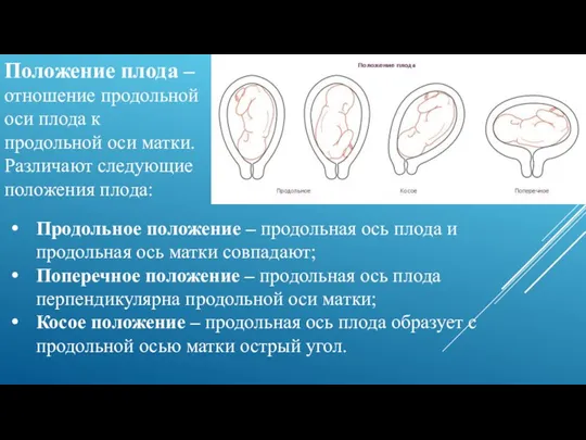 Положение плода – отношение продольной оси плода к продольной оси матки. Различают