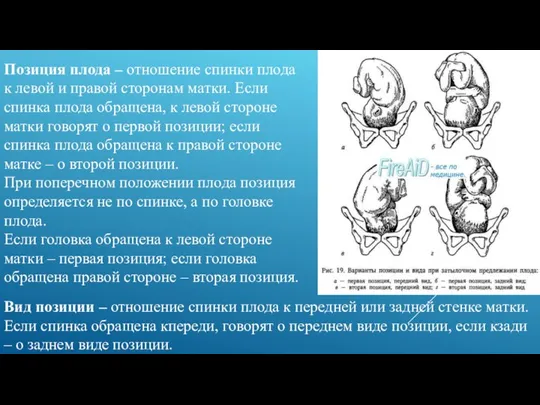 Позиция плода – отношение спинки плода к левой и правой сторонам матки.