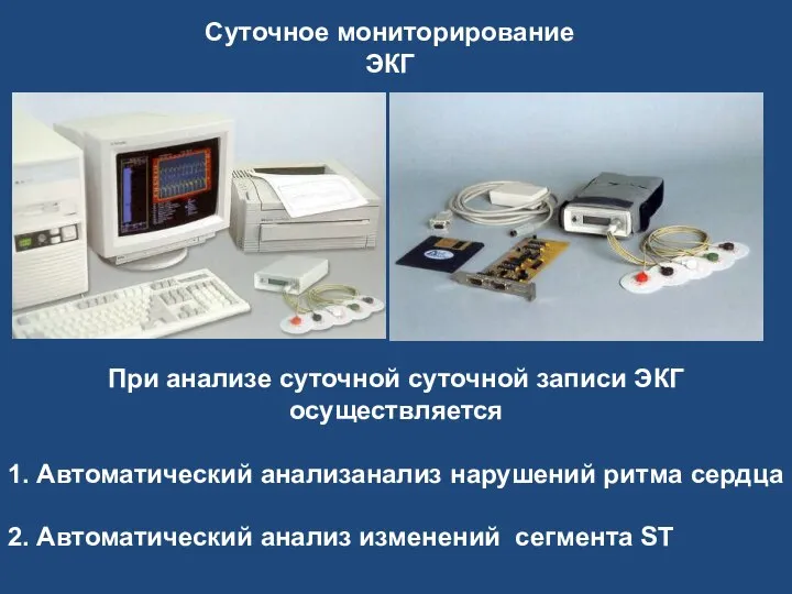 Суточное мониторирование ЭКГ При анализе суточной суточной записи ЭКГ осуществляется 1. Автоматический