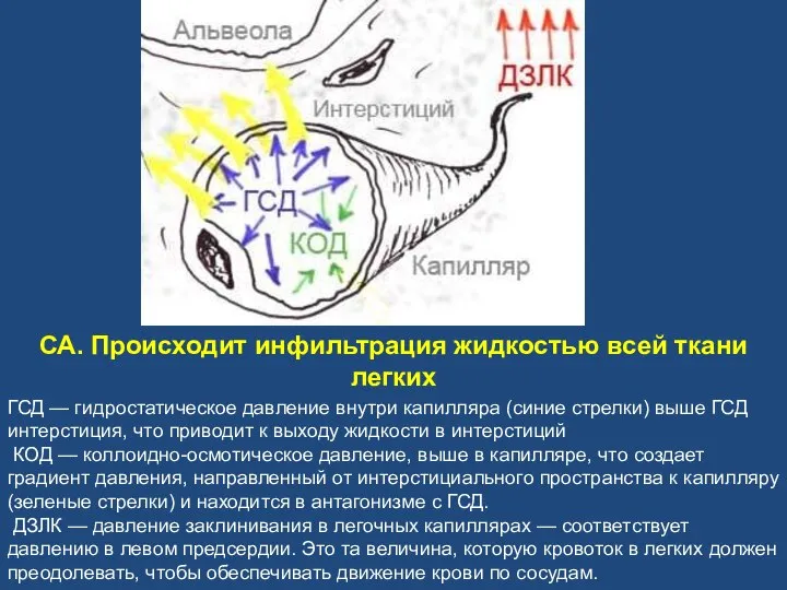 ГСД — гидростатическое давление внутри капилляра (синие стрелки) выше ГСД интерстиция, что