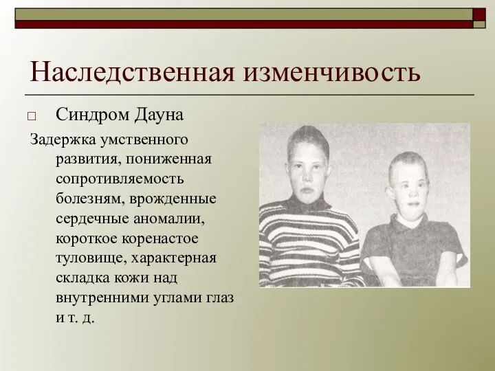 Наследственная изменчивость Синдром Дауна Задержка умственного развития, пониженная сопротивляемость болезням, врожденные сердечные