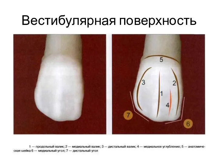 Вестибулярная поверхность