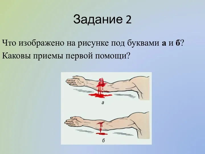 Задание 2 Что изображено на рисунке под буквами а и б? Каковы приемы первой помощи?