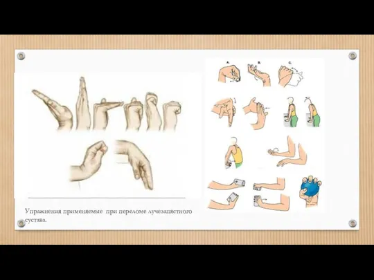 Упражнения применяемые при переломе лучезапястного сустава.