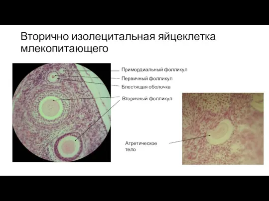 Вторично изолецитальная яйцеклетка млекопитающего Примордиальный фолликул Первичный фолликул Блестящая оболочка Вторичный фолликул Атретическое тело