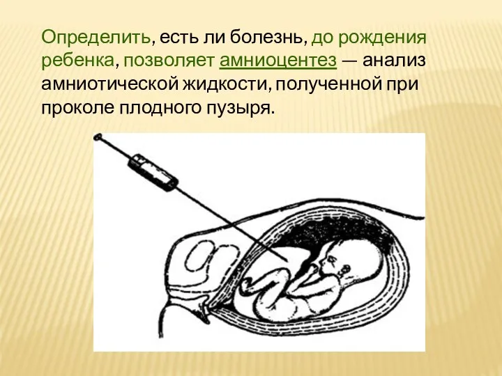 Определить, есть ли болезнь, до рождения ребенка, позволяет амниоцентез — анализ амниотической