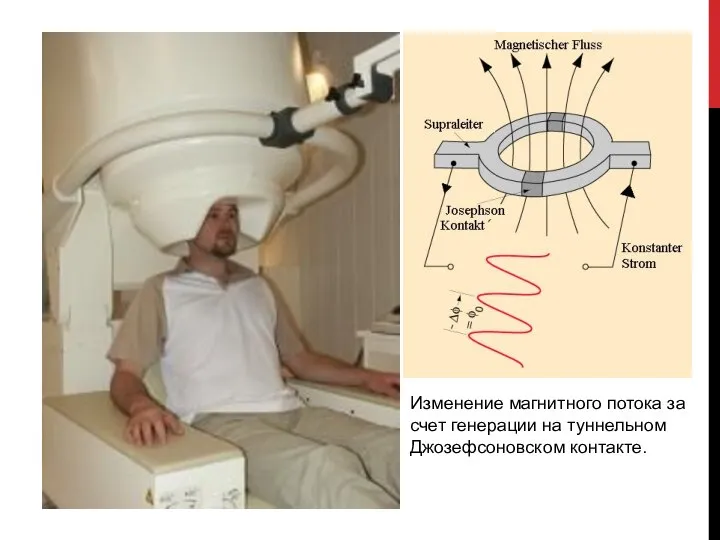 Изменение магнитного потока за счет генерации на туннельном Джозефсоновском контакте.
