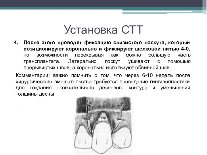 Установка СТТ После этого проводят фиксацию слизистого лоскута, который позиционируют коронально и