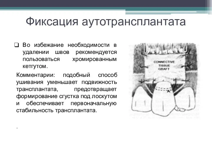 Фиксация аутотрансплантата Во избежание необходимости в удалении швов рекомендуется пользоваться хромированным кетгутом.