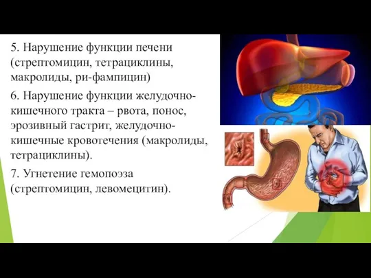 5. Нарушение функции печени (стрептомицин, тетрациклины, макролиды, ри-фампицин) 6. Нарушение функции желудочно-кишечного