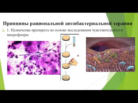 Принципы рациональной антибактериальной терапии 1. Назначение препарата на основе исследования чувствительности микрофлоры