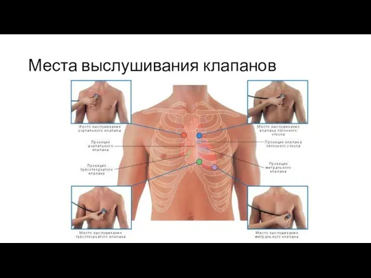 Места выслушивания клапанов