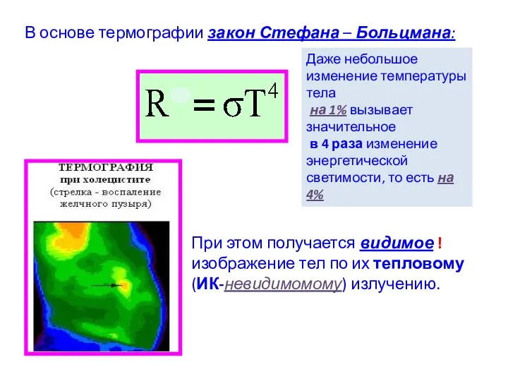 В основе термографии закон Стефана – Больцмана: Даже небольшое изменение температуры тела