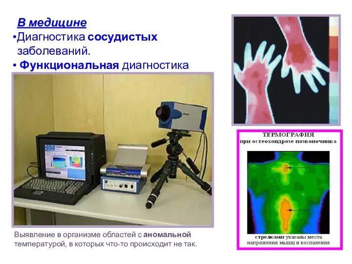 В медицине Диагностика сосудистых заболеваний. Функциональная диагностика Выявление в организме областей с