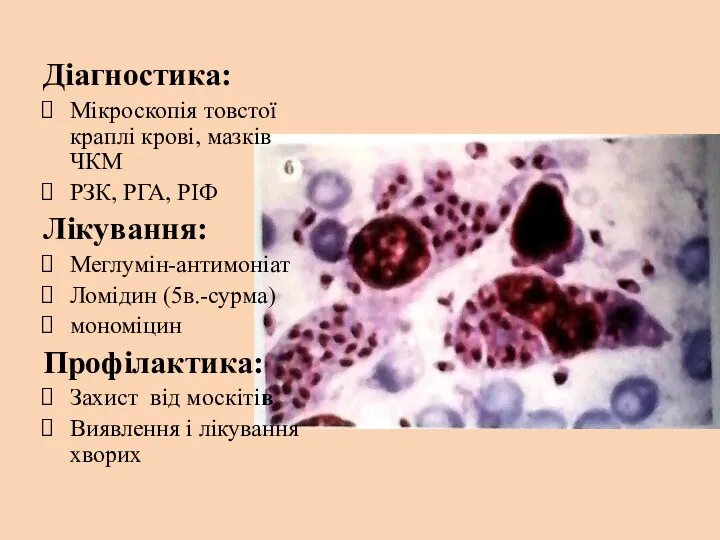 Діагностика: Мікроскопія товстої краплі крові, мазків ЧКМ РЗК, РГА, РІФ Лікування: Меглумін-антимоніат