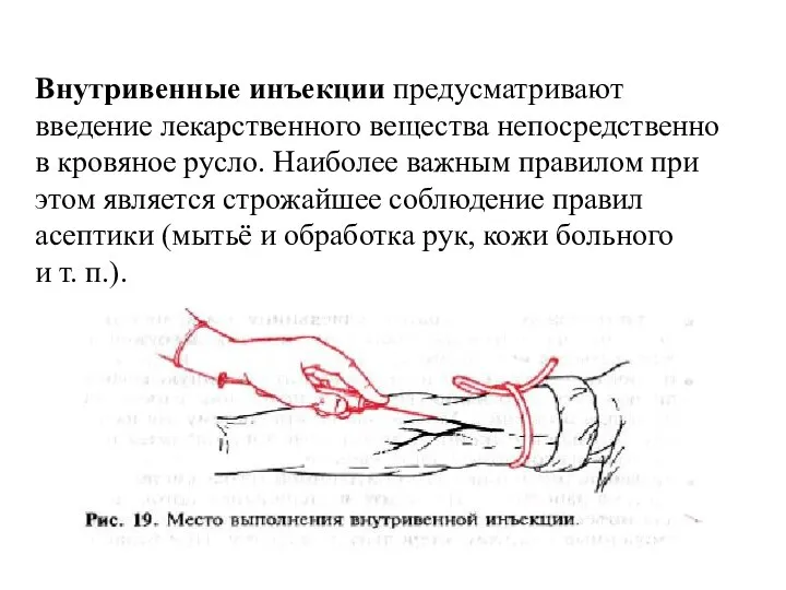 Внутривенные инъекции предусматривают введение лекарственного вещества непосредственно в кровяное русло. Наиболее важным