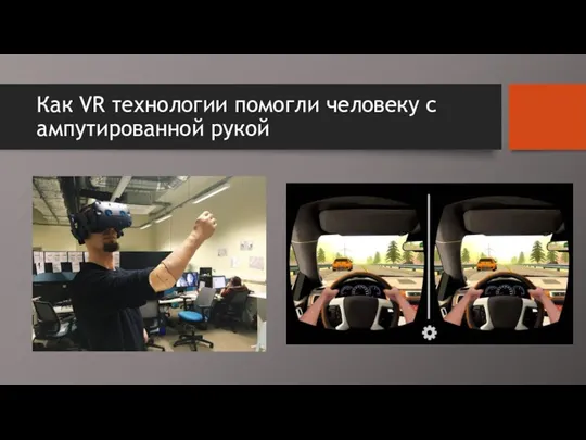 Как VR технологии помогли человеку с ампутированной рукой