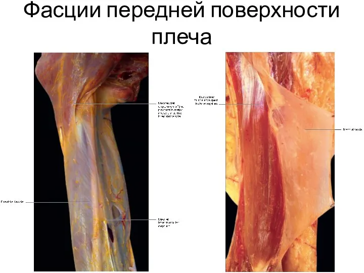 Фасции передней поверхности плеча