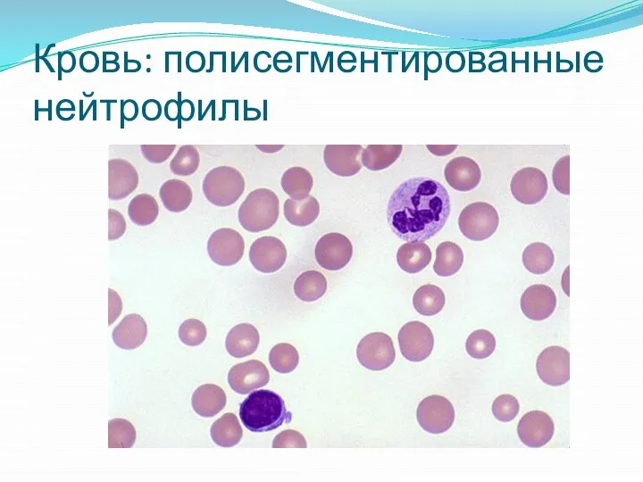 Кровь: полисегментированные нейтрофилы