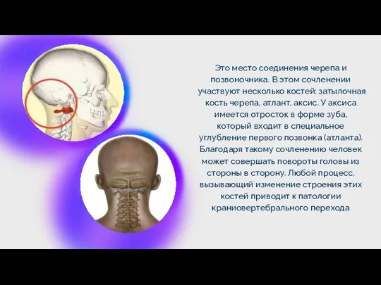 . Это место соединения черепа и позвоночника. В этом сочленении участвуют несколько