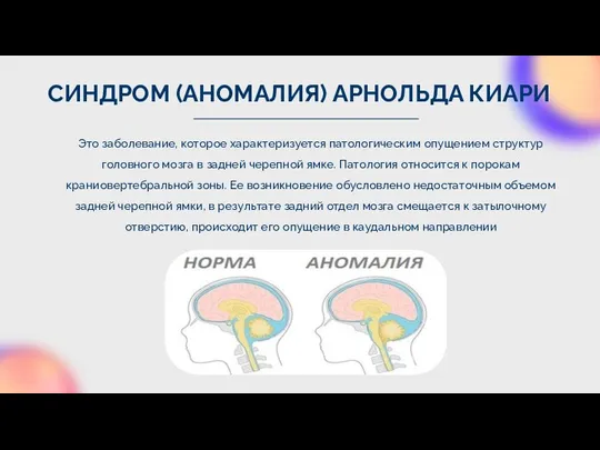 СИНДРОМ (АНОМАЛИЯ) АРНОЛЬДА КИАРИ Это заболевание, которое характеризуется патологическим опущением структур головного