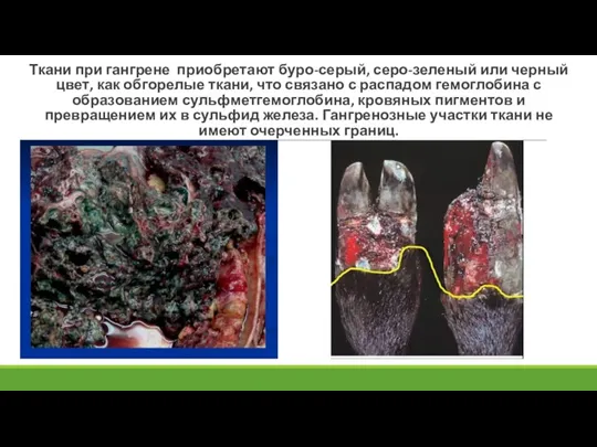 Ткани при гангрене приобретают буро-серый, серо-зеленый или черный цвет, как обгорелые ткани,
