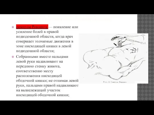 СУЩЕСТВУЕТ РЯД СИМПТОМОВ, КОТОРЫЕ СВЯЗАНЫ С БОЛЬЮ ПРИ АППЕНДИЦИТЕ И НАЗВАНЫ В