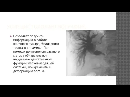 ХОЛЕЦИСТОХОЛАНГИОГРАФИЯ. Позволяет получить информацию о работе желчного пузыря, билиарного тракта в динамике.