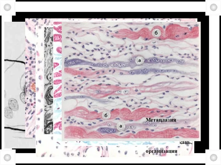 Внутриклеточная гиперплазия Регенерация Грануляционная ткань. Грануляционная ткань организация Метаплазия