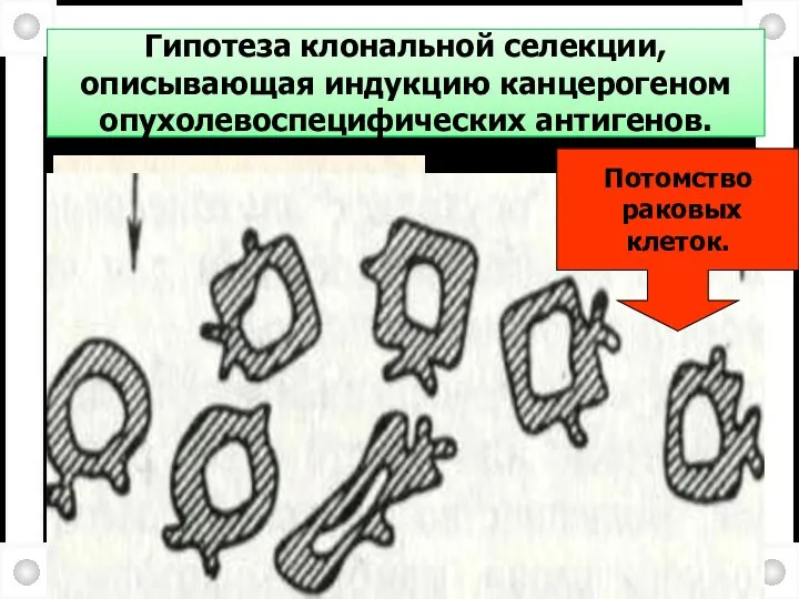 Гипотеза клональной селекции, описывающая индукцию канцерогеном опухолевоспецифических антигенов. Нормальные клетки канцероген Потомство раковых клеток.