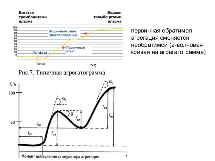 первичная обратимая агрегация сменяется необратимой (2-волновая кривая на агрегатограмме)