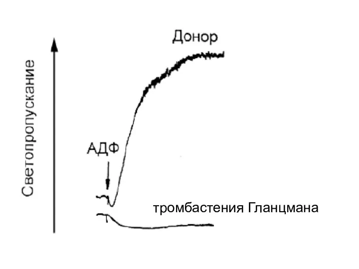 тромбастения Гланцмана