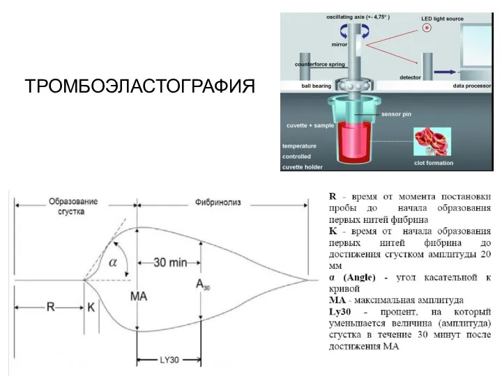 ТРОМБОЭЛАСТОГРАФИЯ