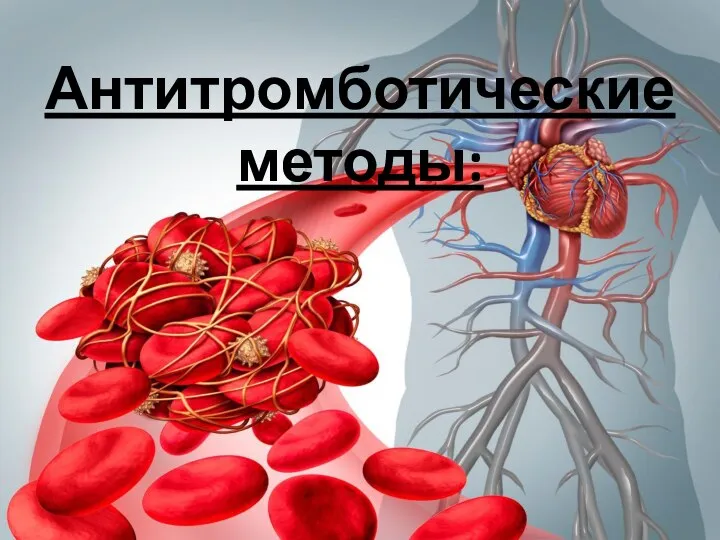 Антитромботические методы: