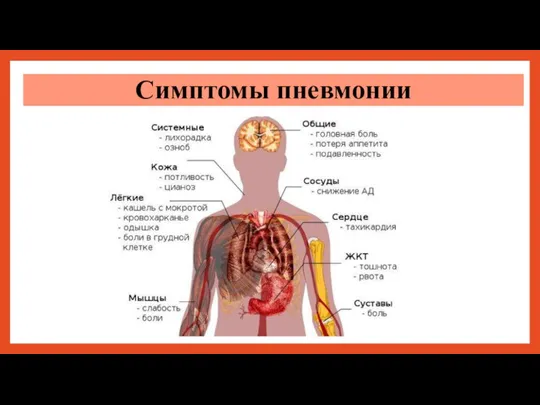 Симптомы пневмонии