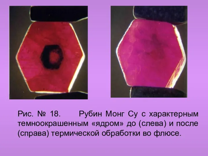 Рис. № 18. Рубин Монг Су с характерным темноокрашенным «ядром» до (слева)